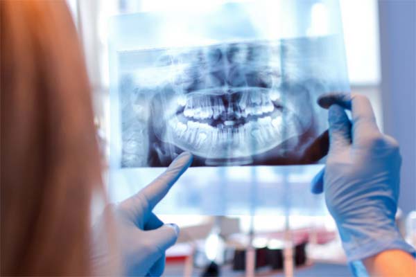 dental x rays safe blog