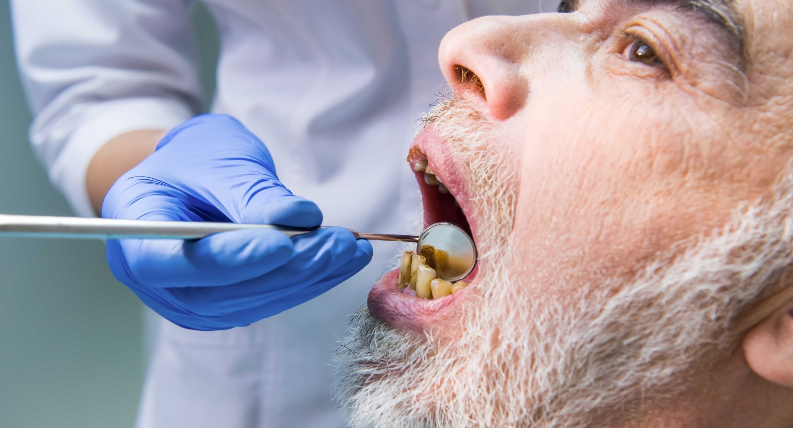 دلایل انجام منظم معاینه دهان و دندان چیست؟