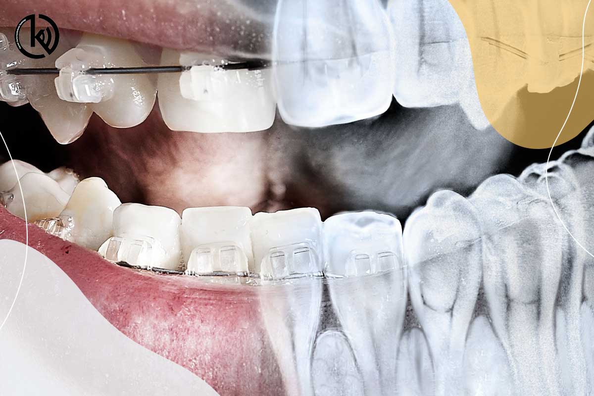 رادیولوژی دندانپزشکی