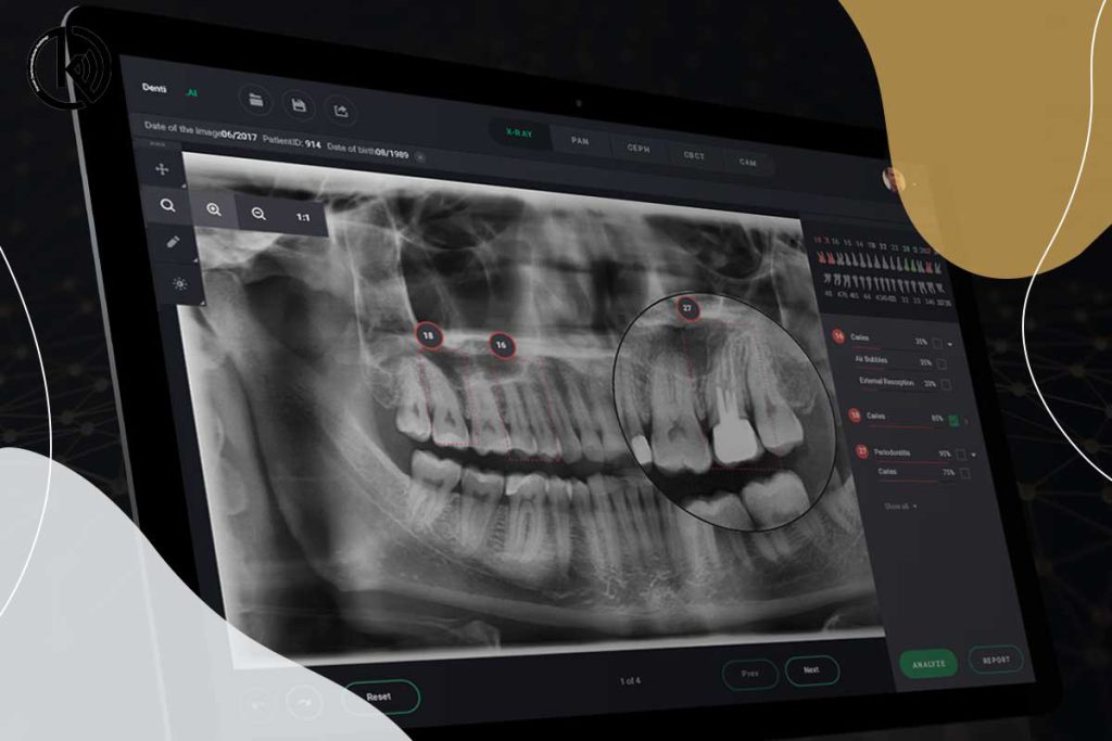 رادیولوژی تخصصی دندانپزشکی