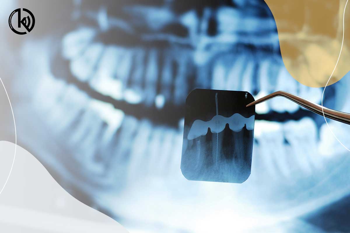 چه کسی باید تحت رادیولوژی دندانپزشکی قرار بگیرند ؟