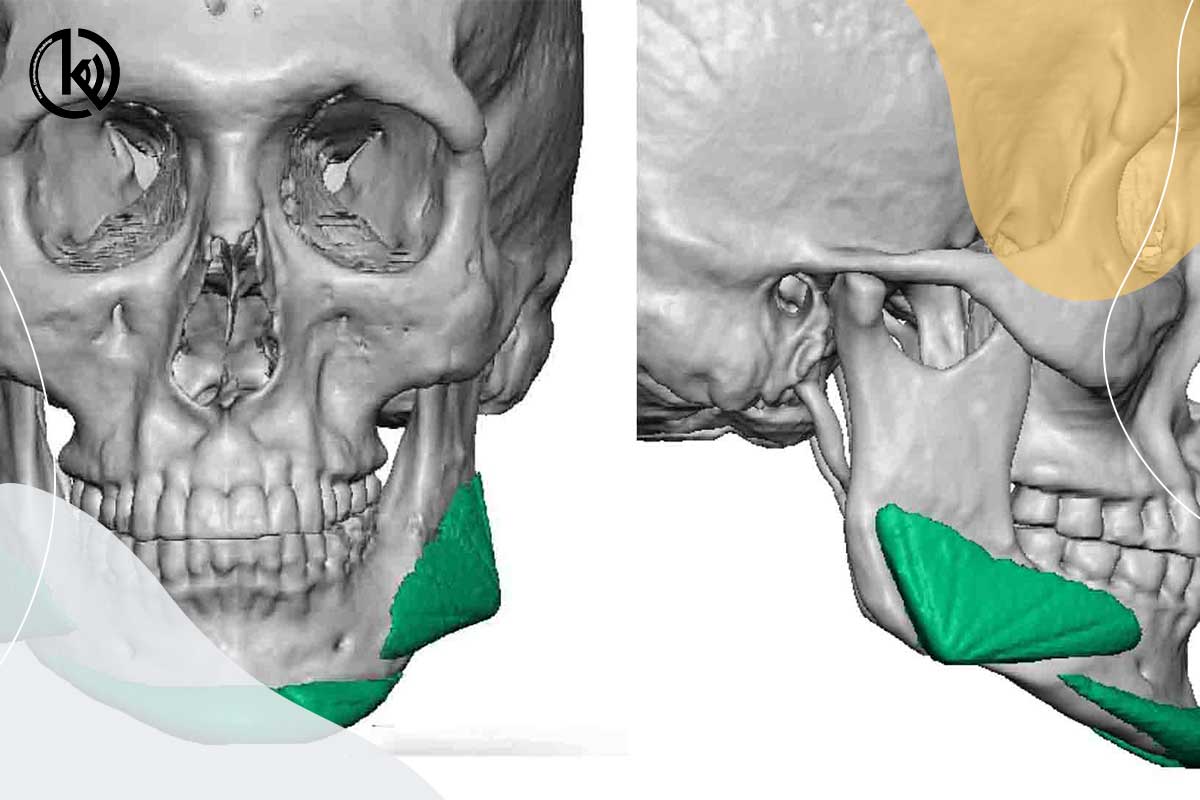 چرا اسکن سه بعدی فک و دندان ترجیح داده می‌شود؟