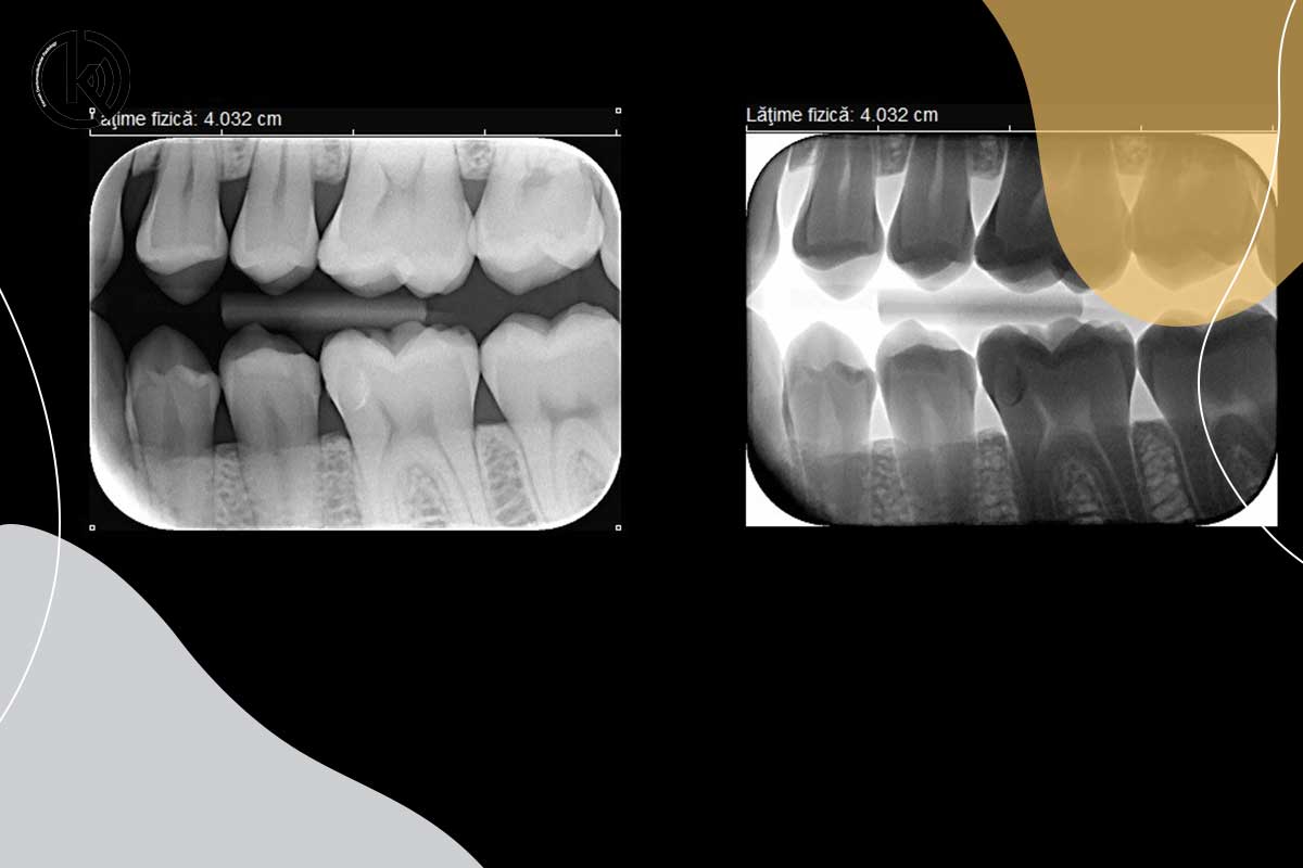 رادیولوژی دهان و دندان چیست؟
