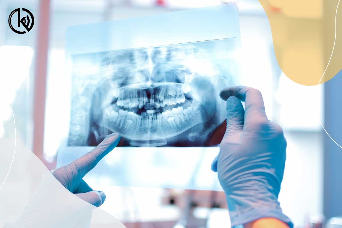 رادیولوژی دندان چه مواردی را می‌تواند تشخیص دهد؟